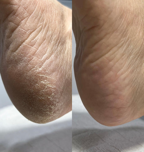 Pedichiura de la 0